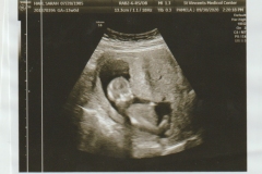 baby-01