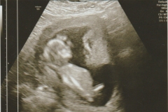 baby-08